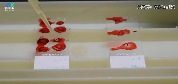 实操视频 | 马松(masson)染色实验操作细节演示