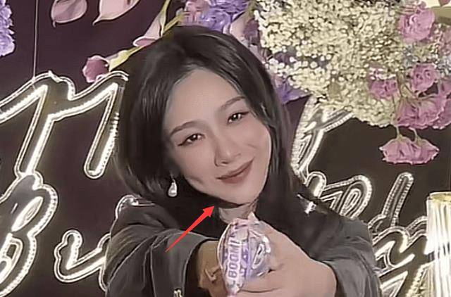 杨紫被质疑整容,晒庆生照模样大变,满脸通红,脸肿僵硬不自然_祝福