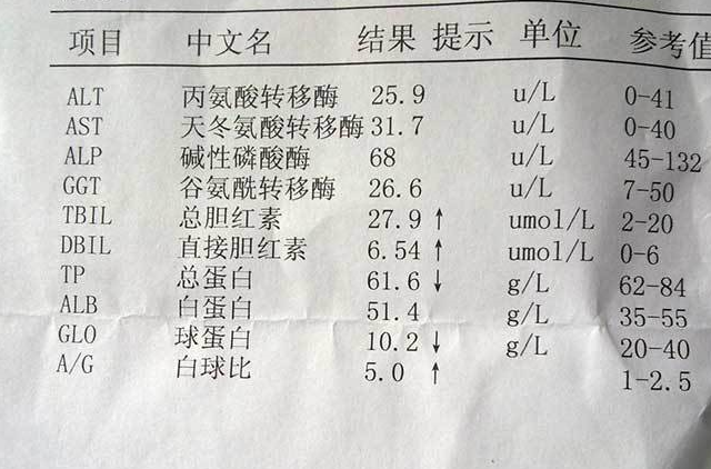 肝功能转氨酶正常,但是胆红素偏高是怎么回事,有可能是肝硬化吗_指标