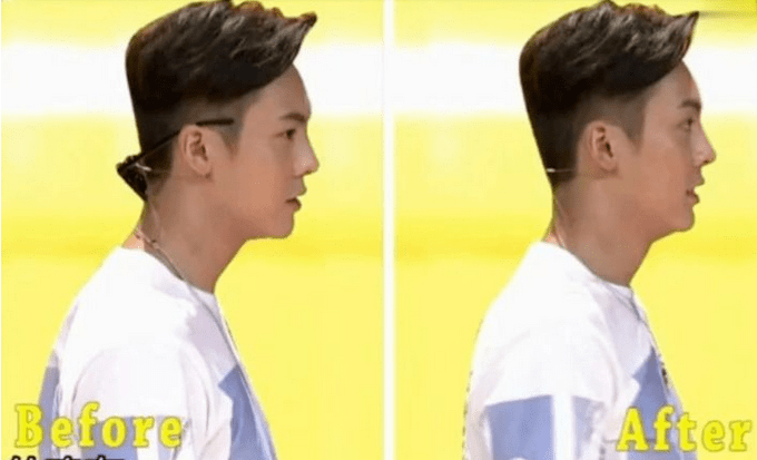 有人在节目中治驼背,有人不吃药躺不下_鹿晗_蔡少芬_陈伟霆