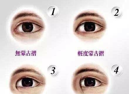 什么是内眦褶?有关于这项的研究,是来自于蒙古大学的一名教授.