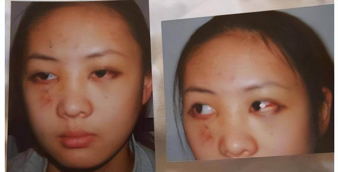 童瑶:被张默当街殴打,嫁大17岁富商王冉,已是张默高攀不起的人_中戏
