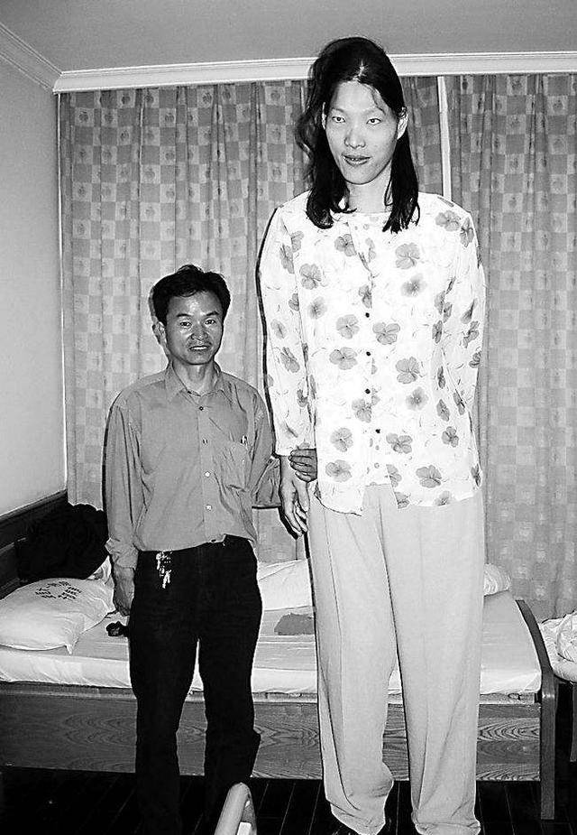 殊不知当时受制于中国农村的认知水平,"巨人症"的敏感字眼还不为全体