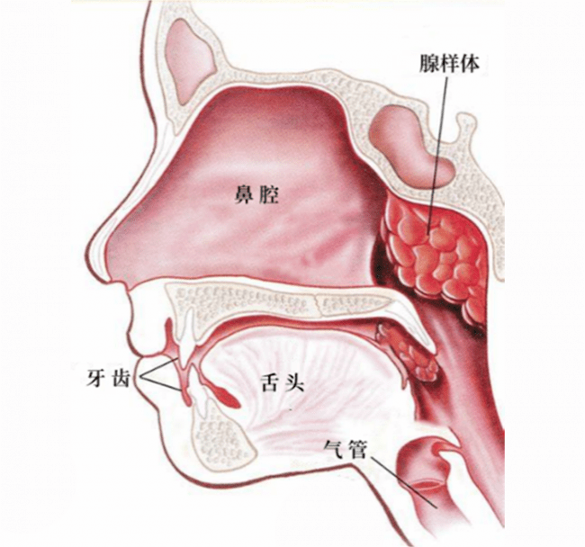 鼻咽部腺图片