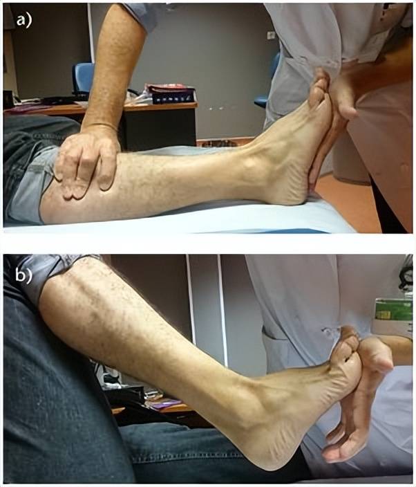 北京大荣诊所胡霞:临床检查对于成功治疗高弓足非常重要_试验_ld_患者