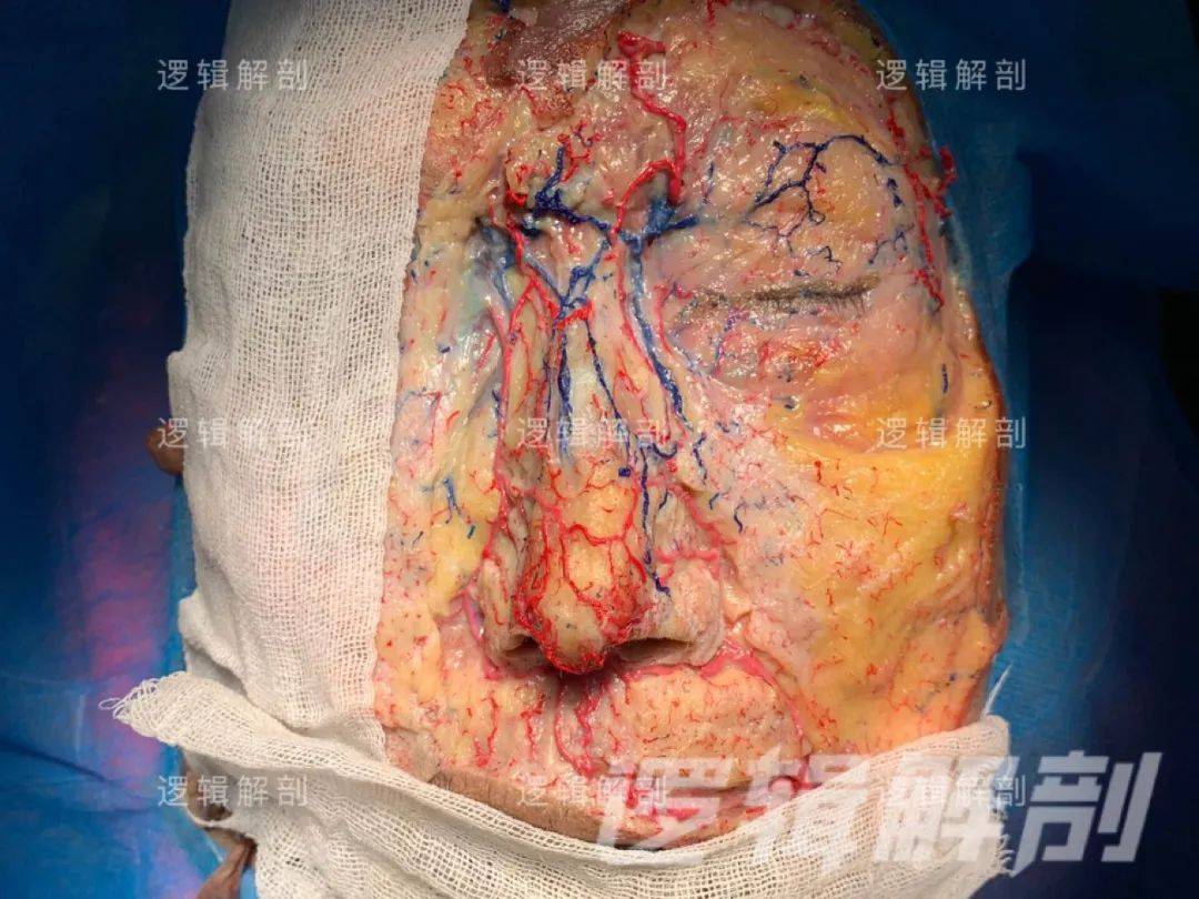 美丽课:鼻部玻尿酸注射,如何避免血管栓塞?(中)