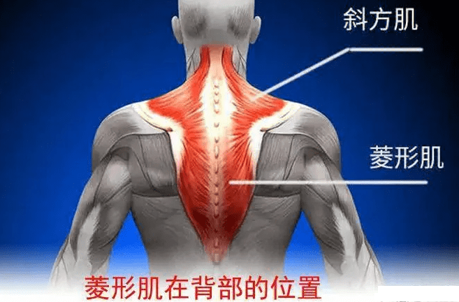 肩膀斜方肌僵硬疼痛怎么解决?保守有效的方法分享给你