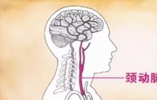 頸動脈堵塞,身體的什麼部位反應最為明顯?_症狀_程度