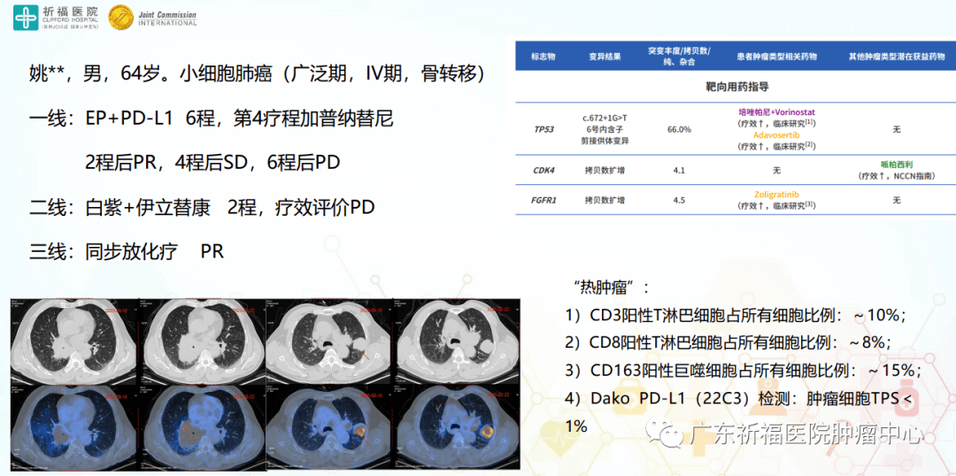 腫瘤精準免疫及個體化治療系列講演1:免疫精準治療理念