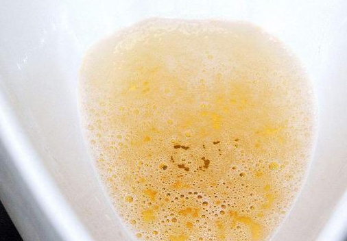 若有这3个表现,偷着乐吧,肾功能很不错_肾脏_尿液_前列腺