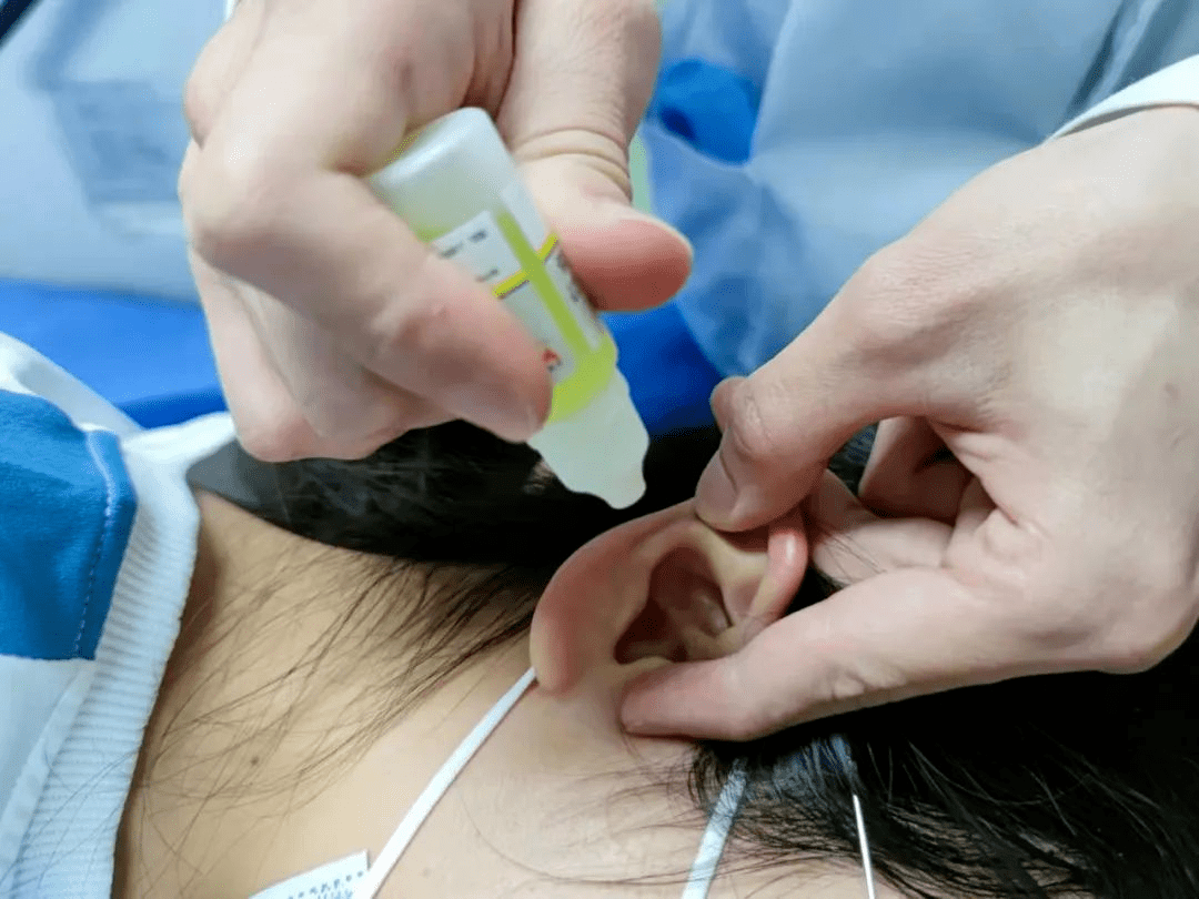 绵阳聪茂听力分享:如何正确使用滴耳液?_外耳道_药液_耳廓