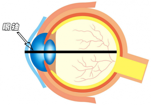 測量眼軸的作用是什麼?用善瞳控制兒童近視_孩子_長度_角膜