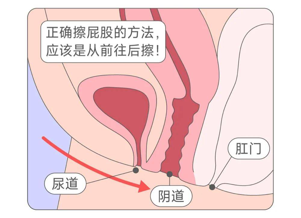 女性尿道长什么样子图片