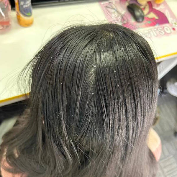 控油蓬松去屑改善毛躁?洗头发去屑止痒排行榜