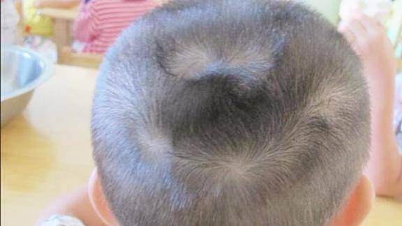 发旋的位置决定了宝宝的智商发旋长在正中的孩子最聪明