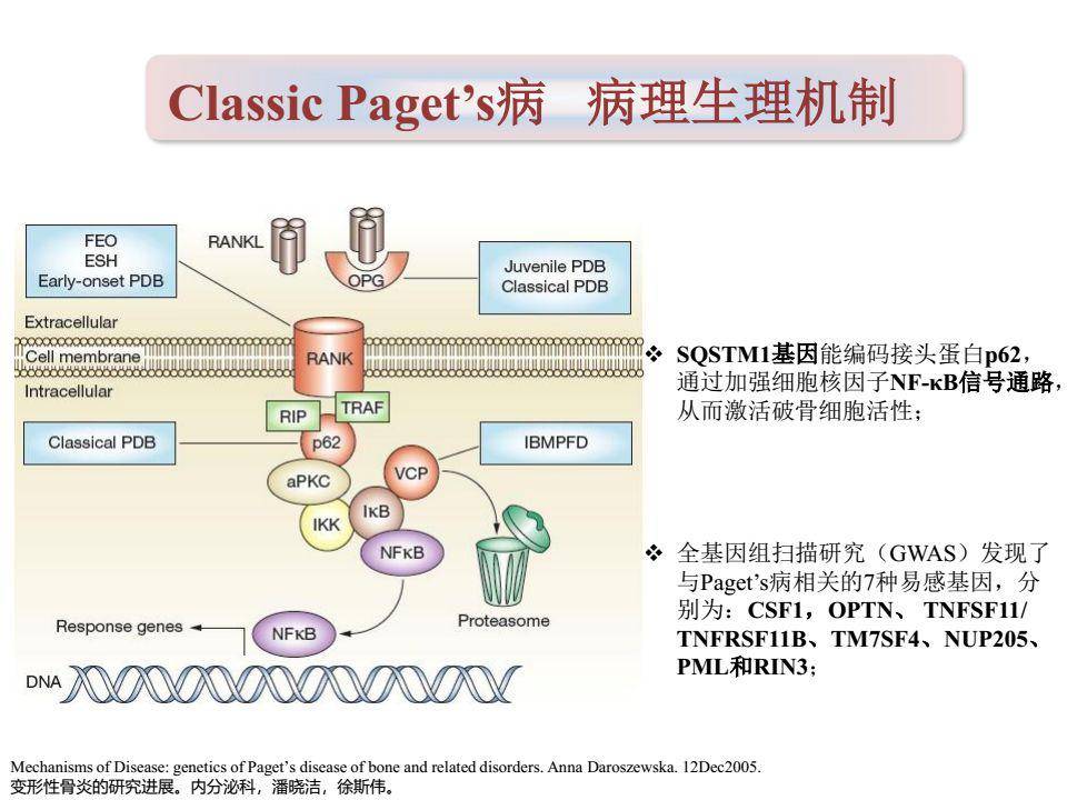 一文搞定paget骨病诊治详解