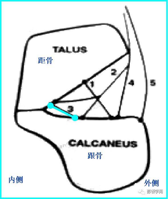 该韧带与跗骨窦方向平均成45°角,走行方向由后内斜向前外通过跗骨管