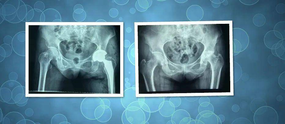 武安一院妙手仁心展风采精湛医术正伤骨祝贺骨三科成立3周年