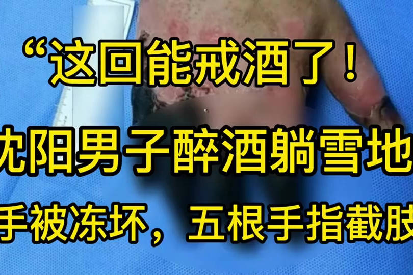 这回能戒酒了沈阳男子醉酒躺雪地手被冻坏五根手指截肢
