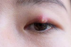 关于二维码微信小程序你所不知道内容