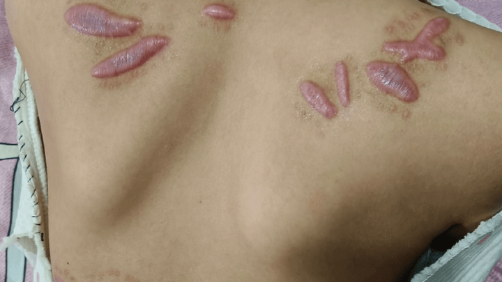 9岁女孩被邻居砍伤，伤人者未满14岁，谁该负刑事责任？