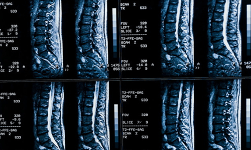 846fa12c56d641e19f8a30d1c94bd59c.png