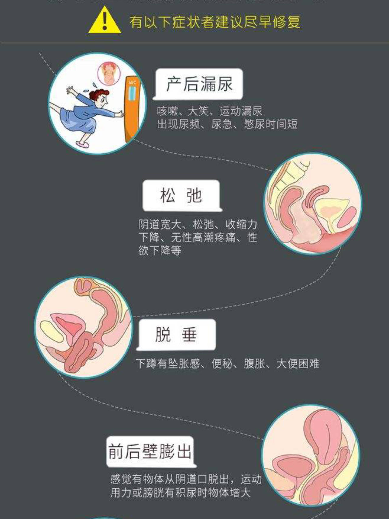 乾貨丨產後媽媽盆底肌腹直肌修復指南