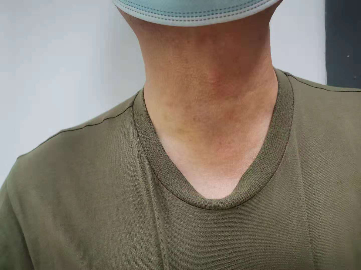 一起来看看甲亢都有什么症状吧!