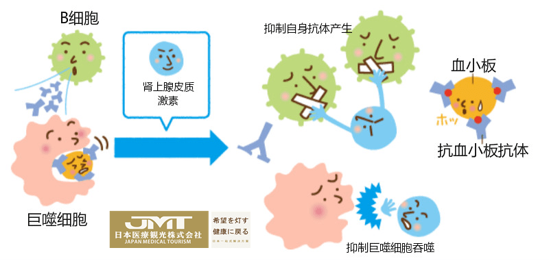 jmt日本医疗原发免疫性血小板减少症itp的日本治疗