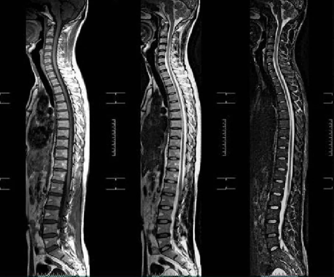 成像|【科室推荐】西安工会医院影像科