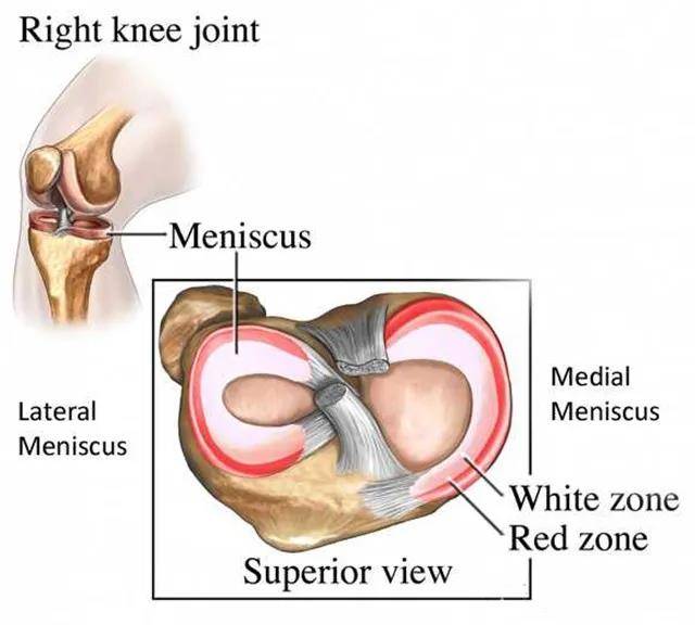 膝关节半月板什么形状图片