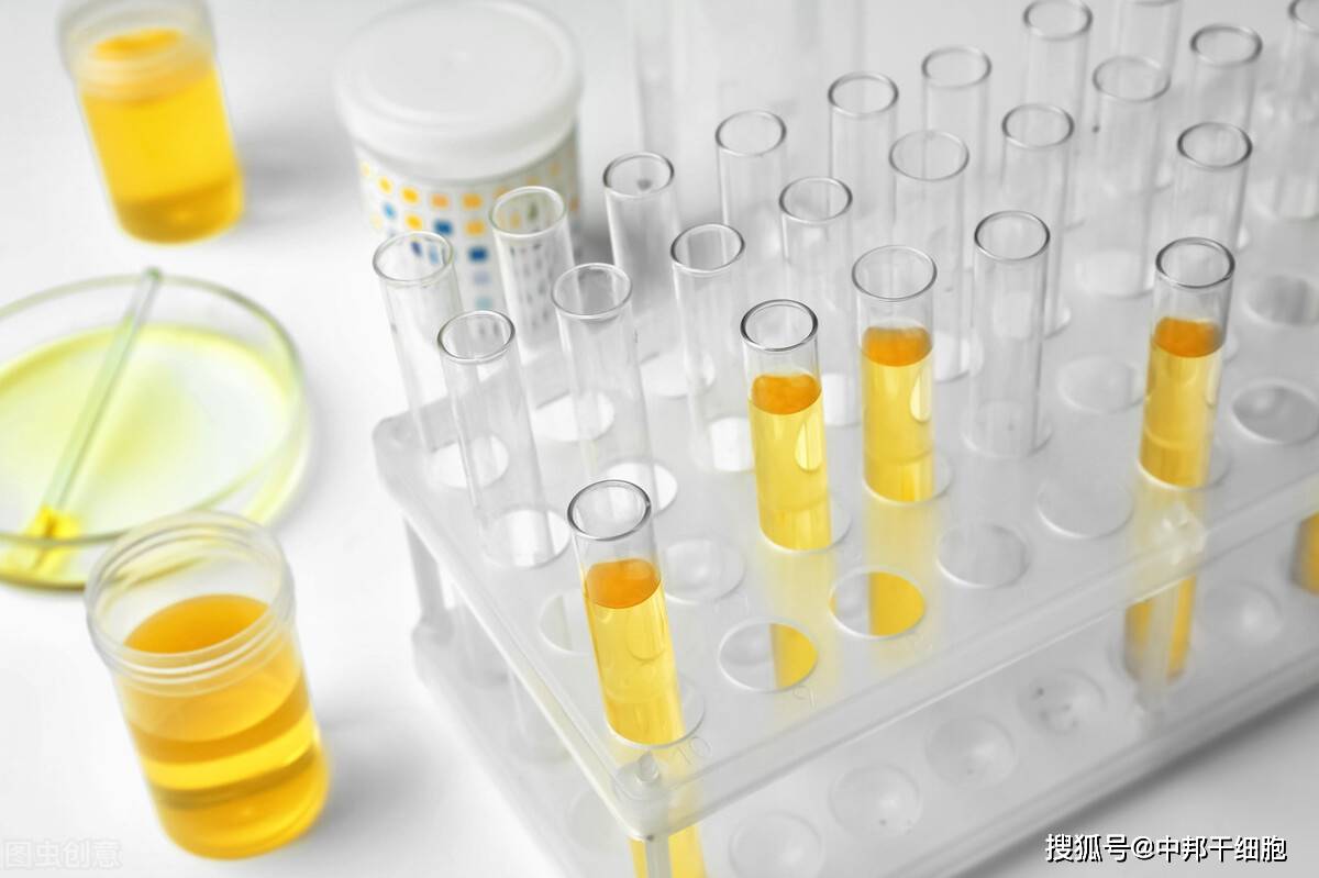 症状|干细胞修复尿毒症，教你如何正确保护肾！