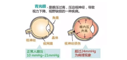 4404fb3e449a4f869a97ab5957fcf349.png
