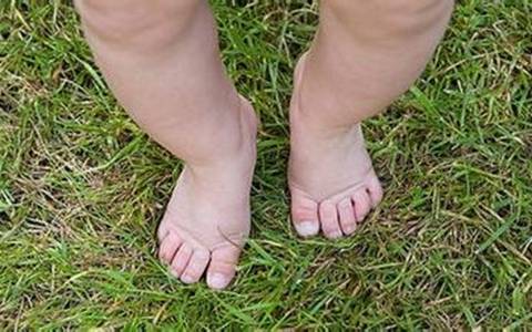 送给新手妈妈教你怎么辨别马蹄足