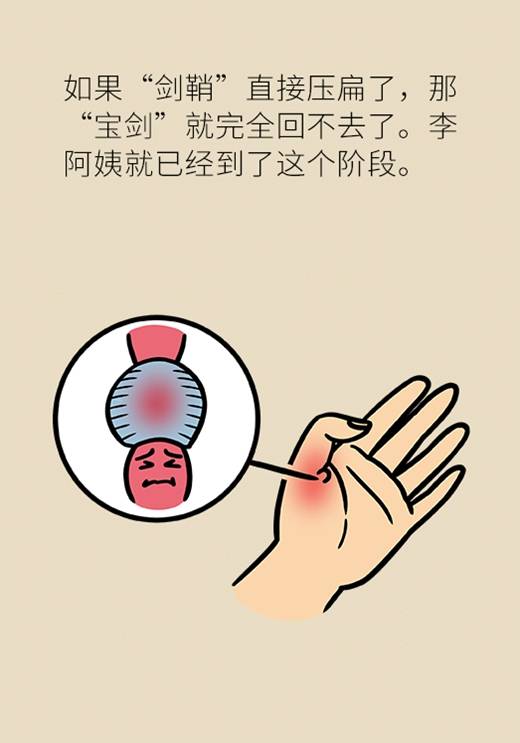 手机,包一按|手上有包一按就疼？手机玩多了都可能得这种病