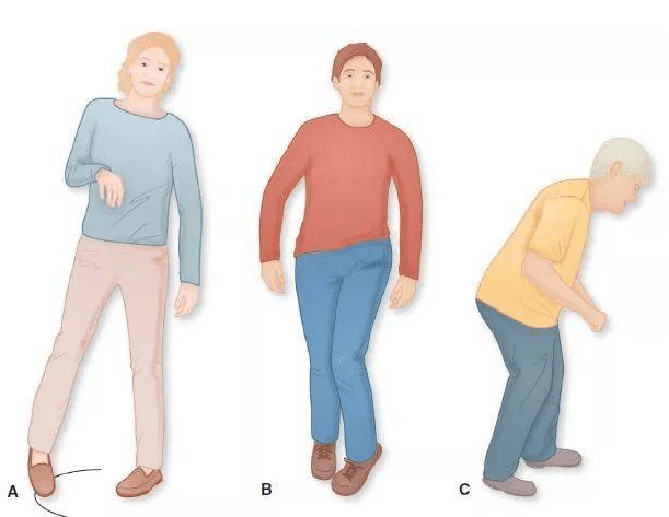 科普|【科普】颅脑损伤所致偏瘫常见症状有哪些？如何选择适合的治疗方案？