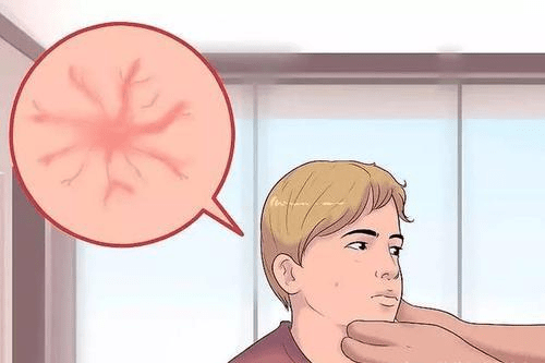 毒素|肝病多是“拖”出来的,身体出现“2臭2红”,莫忽视,是肝在”呼救“