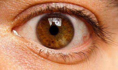 自己怎么测眼压高 51278d2f5e164cd580a93746d4e3b8c4.jpeg