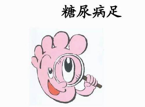 并发症|糖尿病足脚发黑溃烂了能不能不截肢治好？