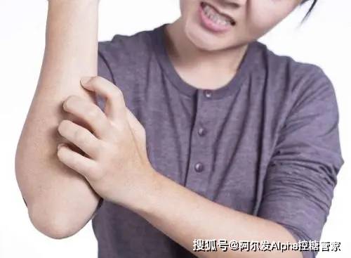 变化|血糖高不高,都写在脸上了