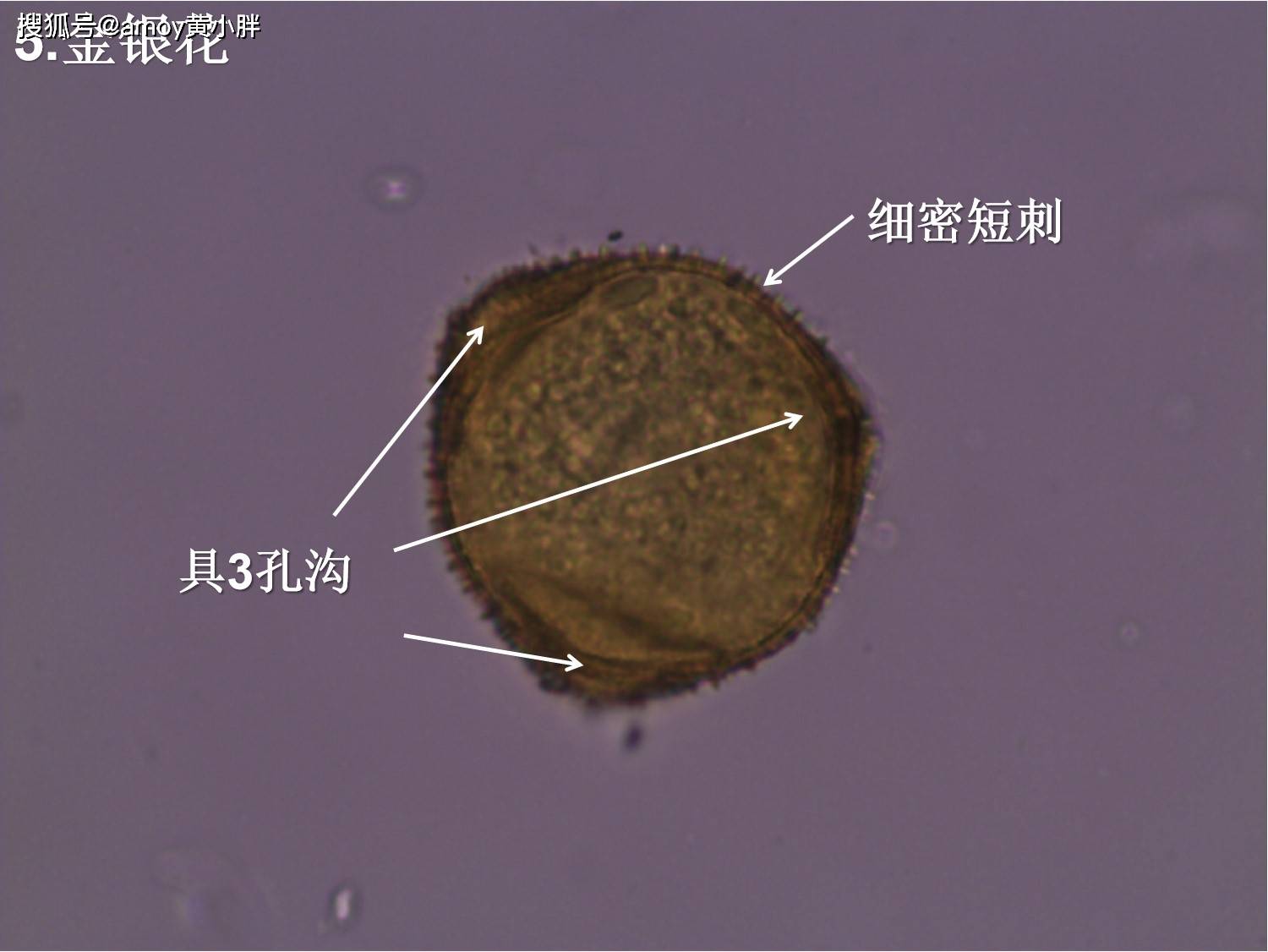 槟榔显微图图片