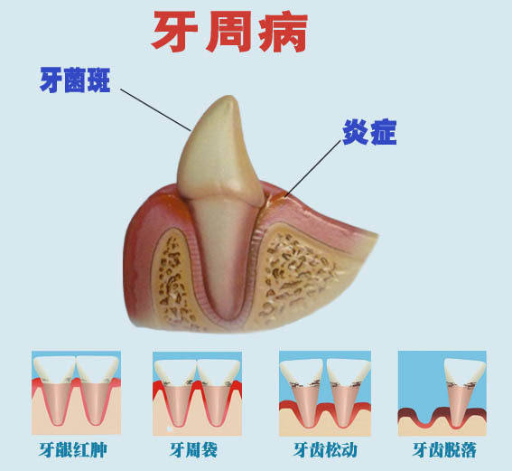 牙齿受外力松动怎么办