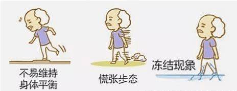 诊断|多系统萎缩疾病影响预后的因素分析