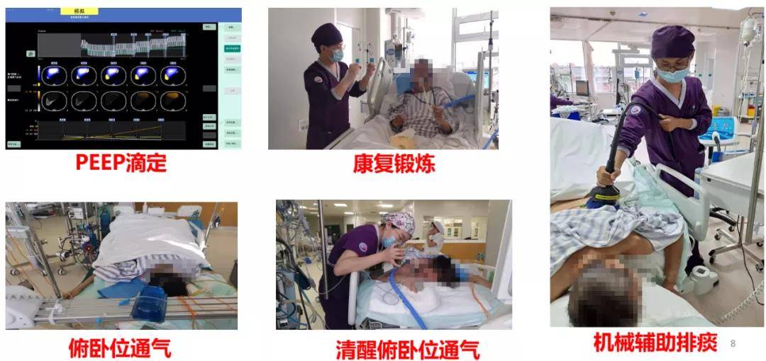 动态|无辐射“动态CT”助力救治多名重症患者