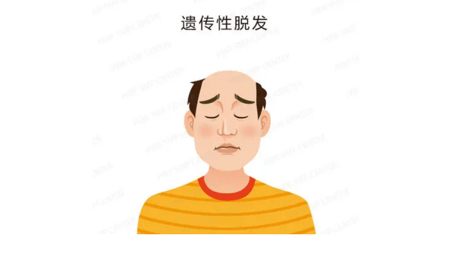 人群黑米3D纹发：纹发老师告诉你，哪些人群适合纹发？