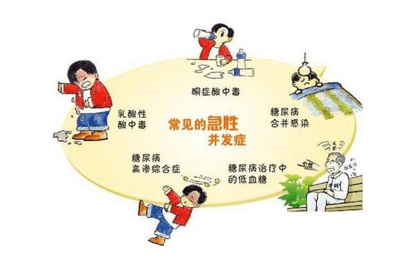 急性并发症:糖尿病都有哪些并发症呢