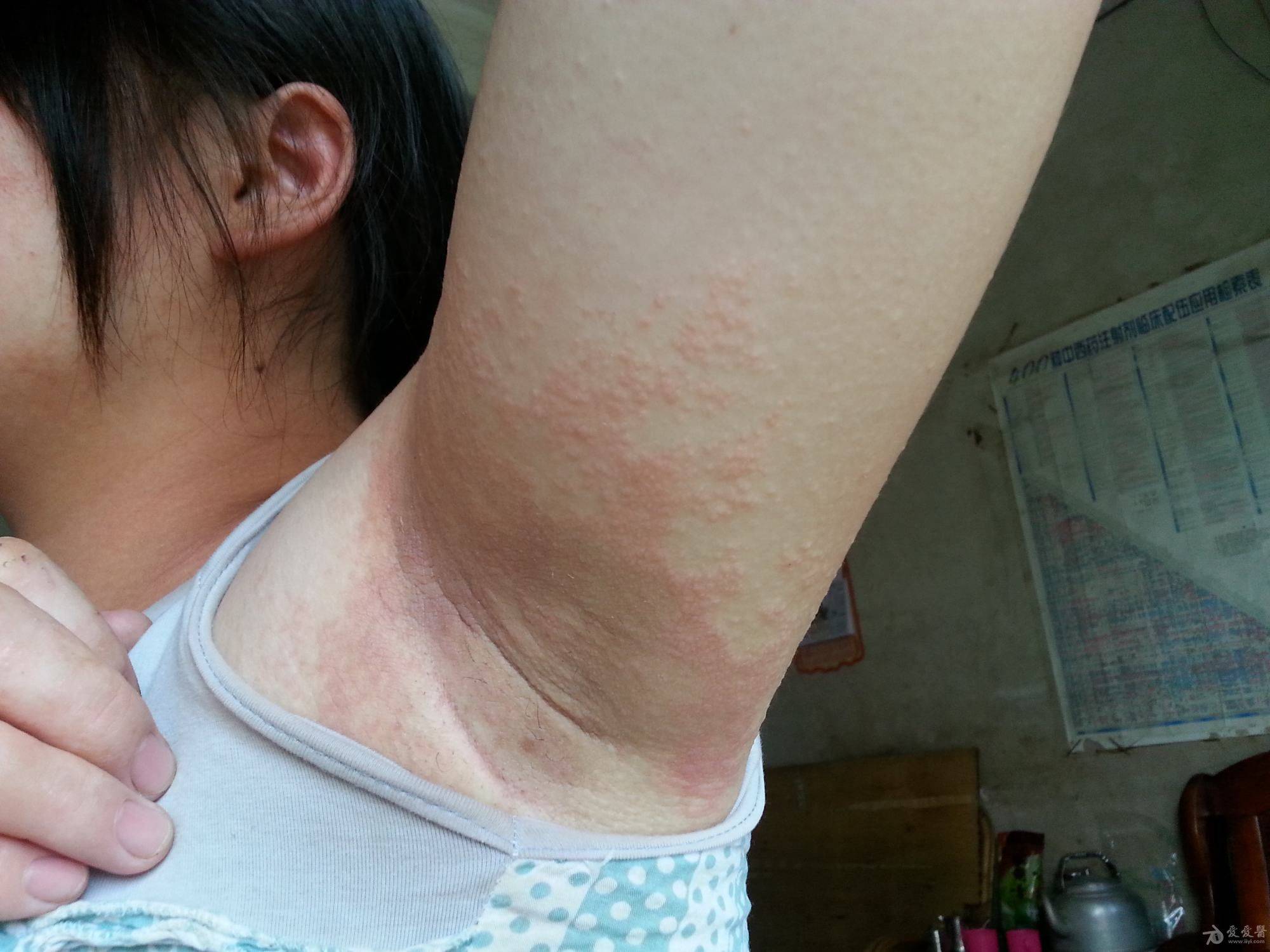 肤康医院效果好不好