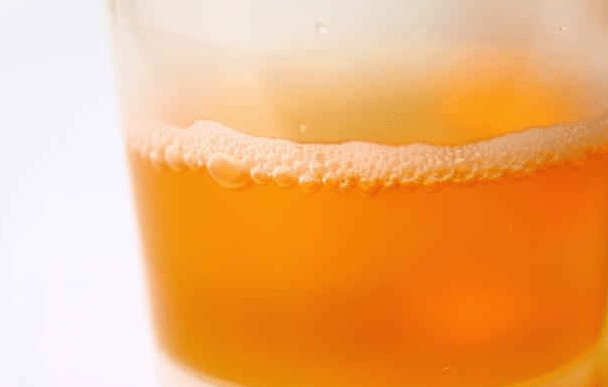 肝脏|肝科医生提醒：晨起出现4表现，多半是肝脏在“求救”！趁早查肝功