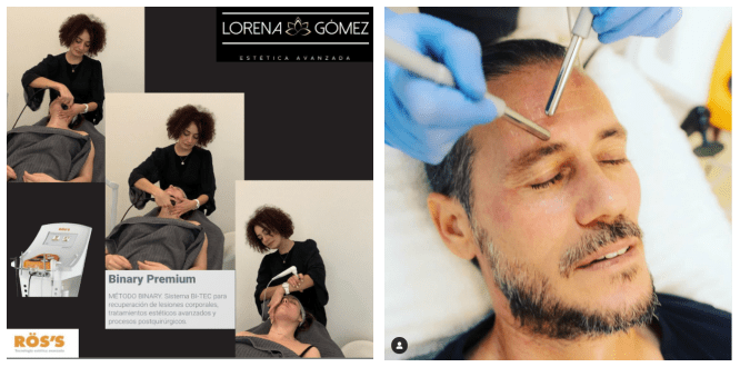 西班牙ross美学缺陷的焕颜一新