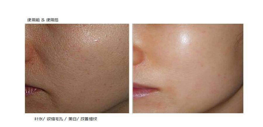 面部第一次做医美怎么选项目？医美小白入门必！